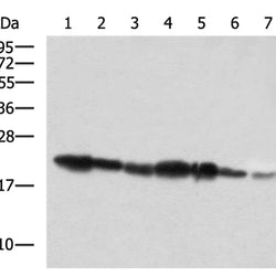 PDCD6 rabbit polyclonal antibody