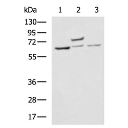 TNFRSF1B rabbit polyclonal antibody