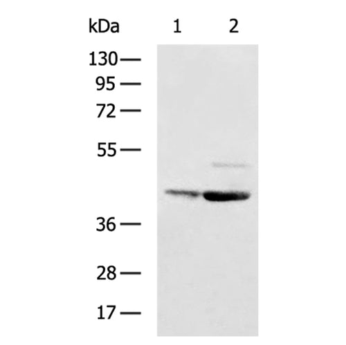NCEH1 rabbit polyclonal antibody