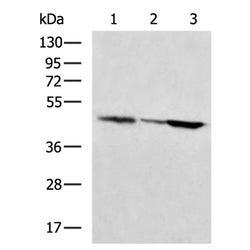 ADA rabbit polyclonal antibody