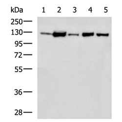 ADAM17 rabbit polyclonal antibody