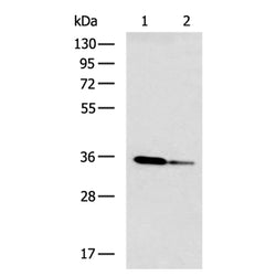 GNMT rabbit polyclonal antibody