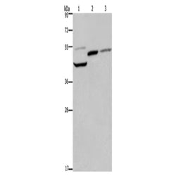 CCN1 rabbit polyclonal antibody