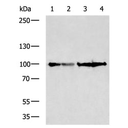 EEF2 rabbit polyclonal antibody