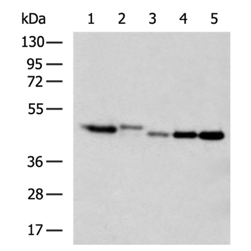 EIF3F rabbit polyclonal antibody