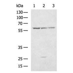 FGB rabbit polyclonal antibody