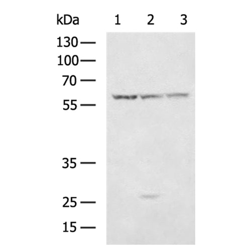 FGB rabbit polyclonal antibody