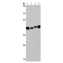 DNAJA1 rabbit polyclonal antibody