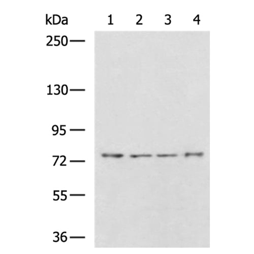 KLHL1 rabbit polyclonal antibody