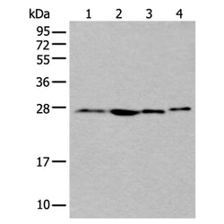 ANP32A rabbit polyclonal antibody