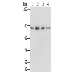 RBM5 rabbit polyclonal antibody
