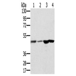 RNH1 rabbit polyclonal antibody