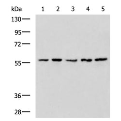 TRIM27 rabbit polyclonal antibody