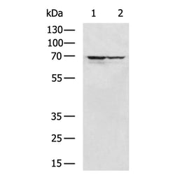 TKT rabbit polyclonal antibody