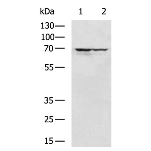 TKT rabbit polyclonal antibody