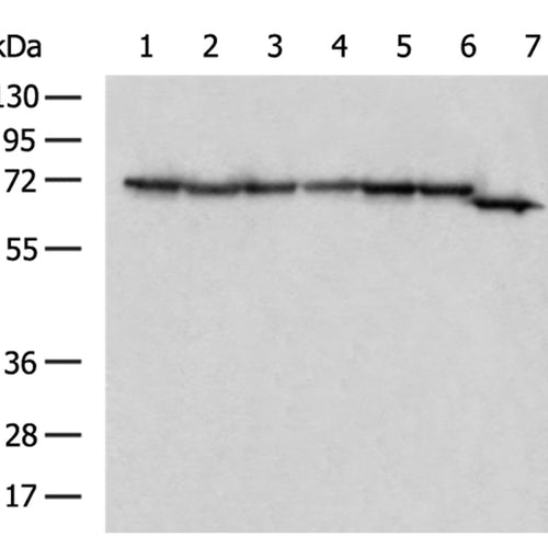 DLAT rabbit polyclonal antibody
