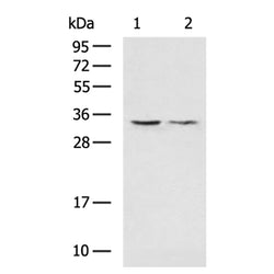 VDAC3 rabbit polyclonal antibody