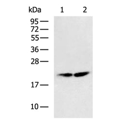 VPS25 rabbit polyclonal antibody