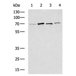 VPS33B rabbit polyclonal antibody