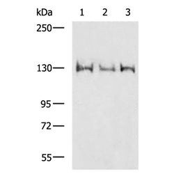 MORC2 rabbit polyclonal antibody