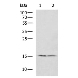 RPS15A rabbit polyclonal antibody