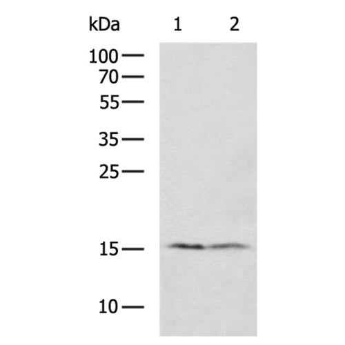 RPS15A rabbit polyclonal antibody