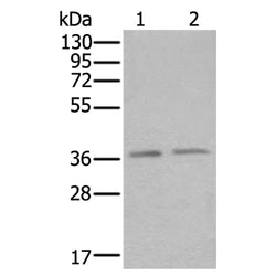 ATXN7L3 rabbit polyclonal antibody