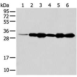 NUDT22 rabbit polyclonal antibody