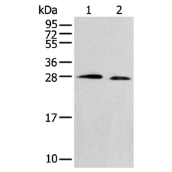 TPPP rabbit polyclonal antibody