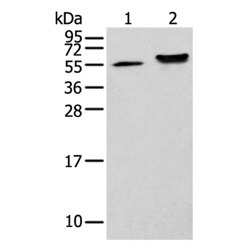 CAPS2 rabbit polyclonal antibody