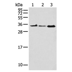 NPL rabbit polyclonal antibody