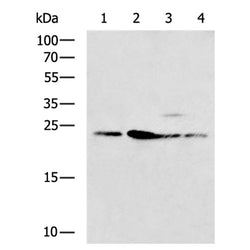 COMMD10 rabbit polyclonal antibody