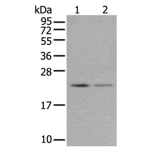 RAB39B rabbit polyclonal antibody