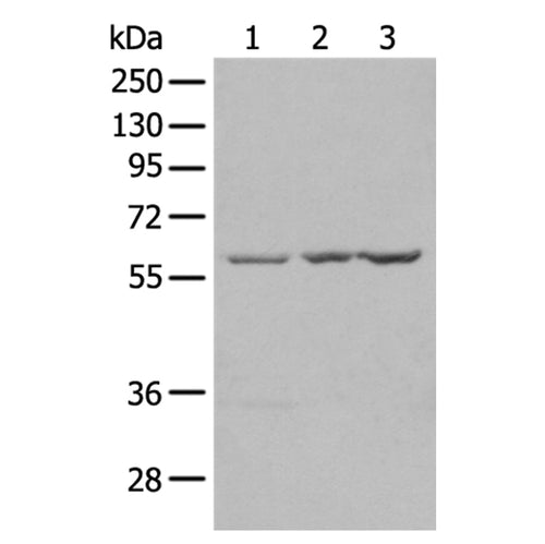 SETD3 rabbit polyclonal antibody