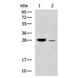 GSTM4 rabbit polyclonal antibody