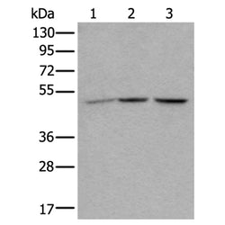 NUDCD3 rabbit polyclonal antibody