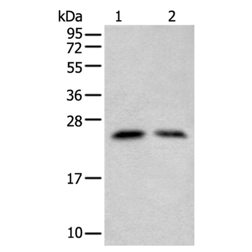 ZNF22 rabbit polyclonal antibody
