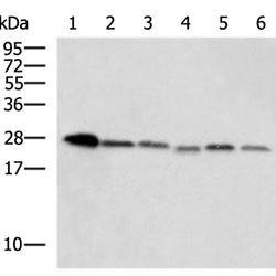ATP6V1E2 rabbit polyclonal antibody