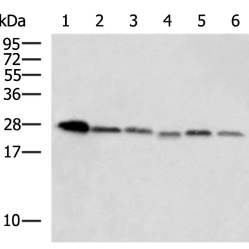 ATP6V1E2 rabbit polyclonal antibody