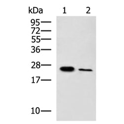 EBI3 rabbit polyclonal antibody