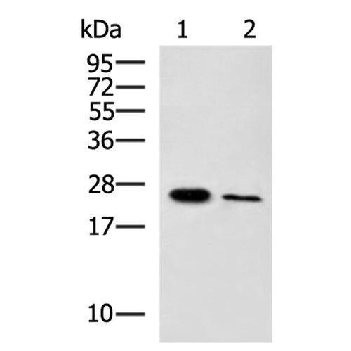 EBI3 rabbit polyclonal antibody