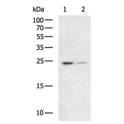 LYPLA1 rabbit polyclonal antibody