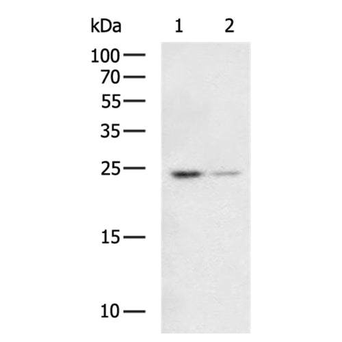LYPLA1 rabbit polyclonal antibody
