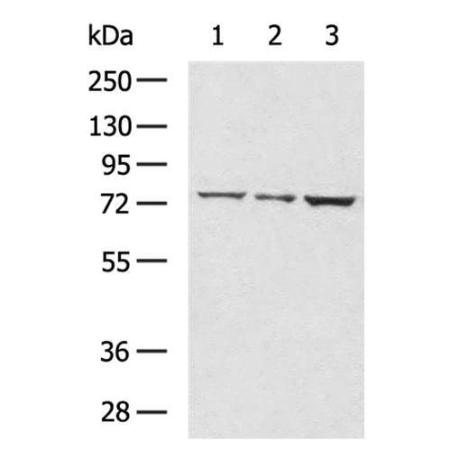 ALKBH8 rabbit polyclonal antibody