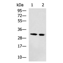 DECR2 rabbit polyclonal antibody