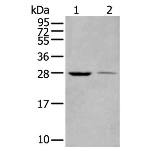 WBP1 rabbit polyclonal antibody