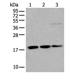 UBE2C rabbit polyclonal antibody