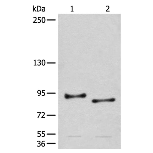 CHRD rabbit polyclonal antibody
