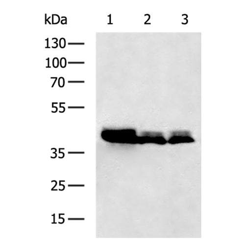 CHST11 rabbit polyclonal antibody
