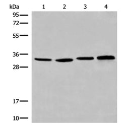 CYB5R1 rabbit polyclonal antibody